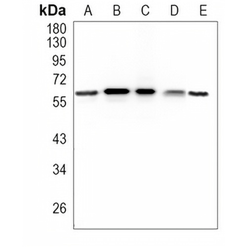 CLPX Rabbit Monoclonal Antibody(C973)