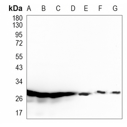SNRPA1 Rabbit Monoclonal Antibody(C974)