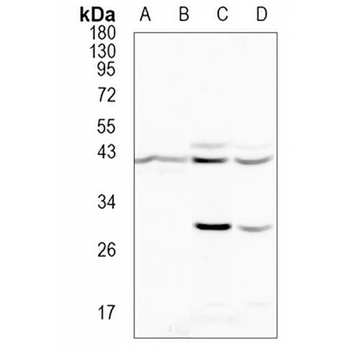 ACTR1B Rabbit Monoclonal Antibody(C975)