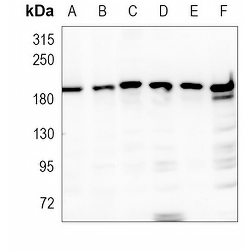 Clathrin Heavy Chain Rabbit Monoclonal Antibody(C976)