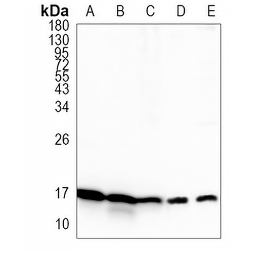 UBCH5 Rabbit Monoclonal Antibody(C979)