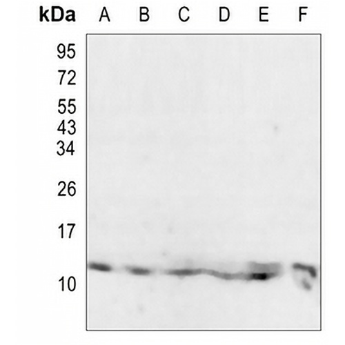 PCBD1 Rabbit Monoclonal Antibody(C980)