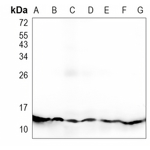 Profilin 1 Rabbit Monoclonal Antibody(C981)