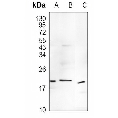 TIMM22 Rabbit Monoclonal Antibody(C982)