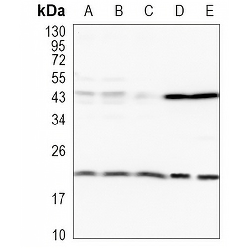 BAX Rabbit Monoclonal Antibody(C983)