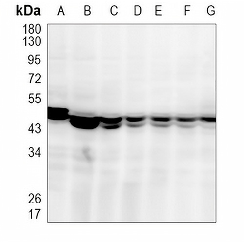 SEC61A2 Rabbit Monoclonal Antibody(C984)