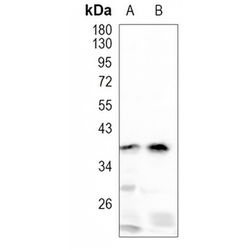 RGMA Rabbit Monoclonal Antibody(C985)