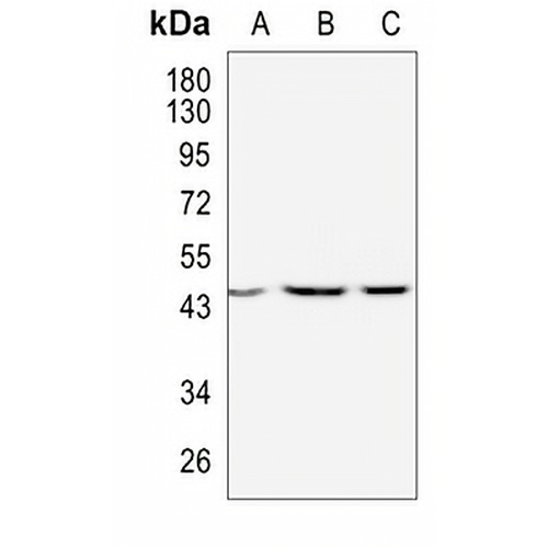 WNT2B Rabbit Monoclonal Antibody(C986)