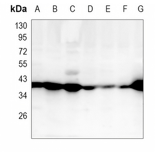 MHC class I Rabbit Monoclonal Antibody(C987)