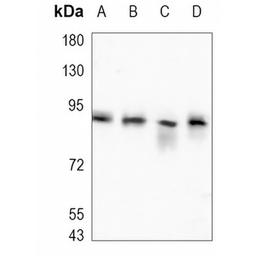 Beta-catenin Rabbit Monoclonal Antibody(C988)