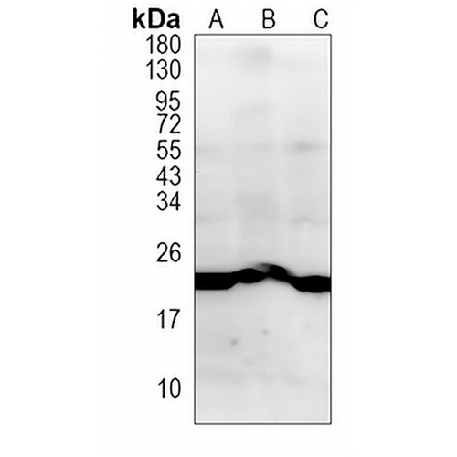 WFDC2 Rabbit Monoclonal Antibody(C990)