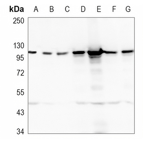 ACTN2 Rabbit Monoclonal Antibody(C991)