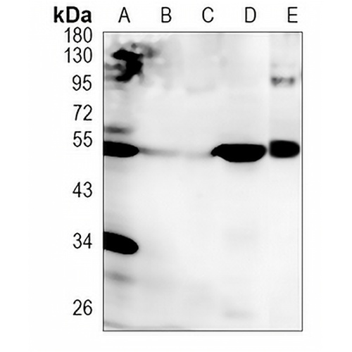 VSX2 Rabbit Monoclonal Antibody(C992)
