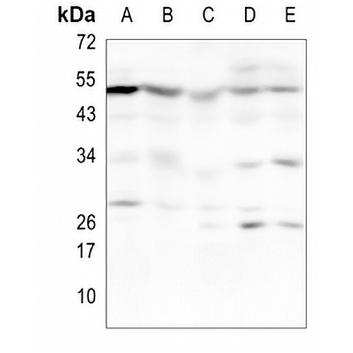 CaMK2 alpha/beta/delta/gamma Rabbit Monoclonal Antibody(C993)