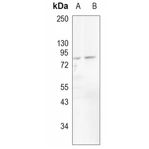 WASF2 Rabbit Monoclonal Antibody(C996)