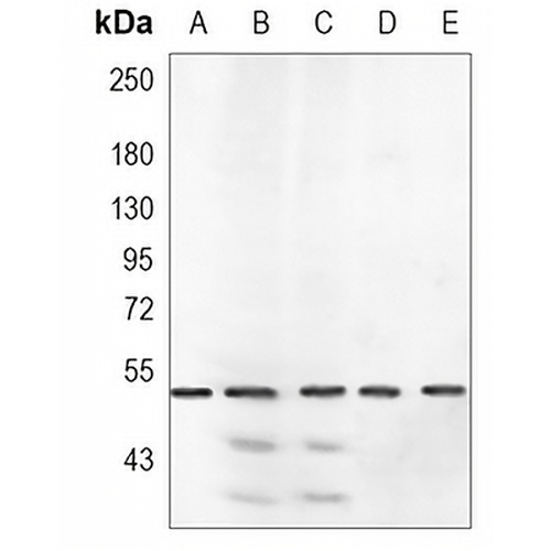 ROR beta Rabbit Monoclonal Antibody(C997)