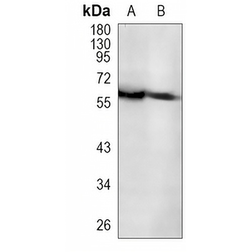 TUB Rabbit Monoclonal Antibody(C999)