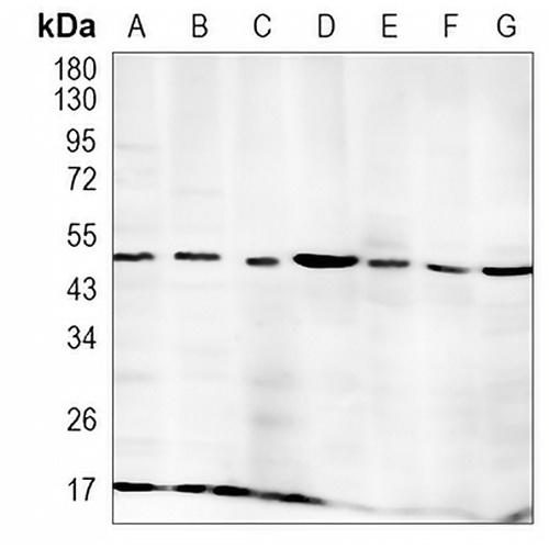 Fukutin Rabbit Monoclonal Antibody(C1000)