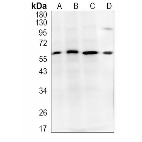 SAP61 Rabbit Monoclonal Antibody(C1002)