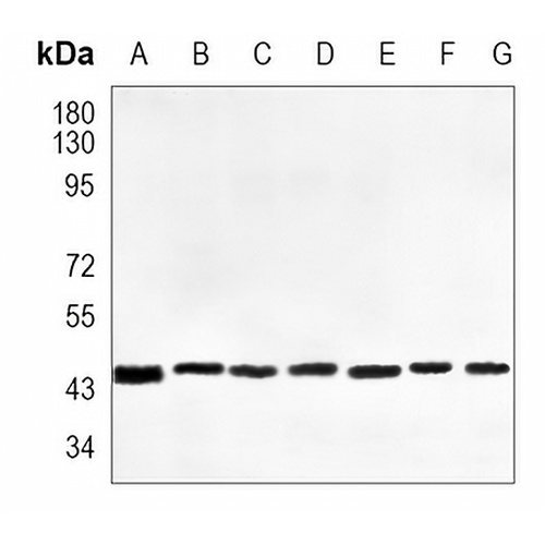 DNAJA4 Rabbit Monoclonal Antibody(C1003)