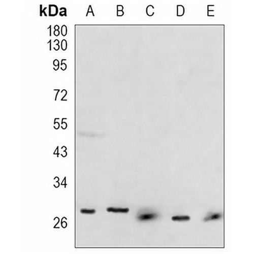 HIF PHD3 Rabbit Monoclonal Antibody(C1004)