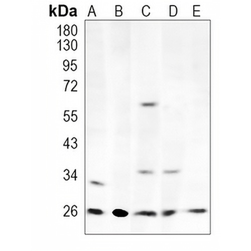 MTAP Rabbit Monoclonal Antibody(C1005)