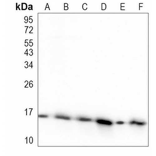 LC3-I/II Rabbit Monoclonal Antibody(C1007)