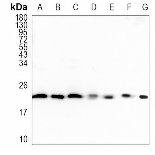 CSN8 Rabbit Monoclonal Antibody(C1013)