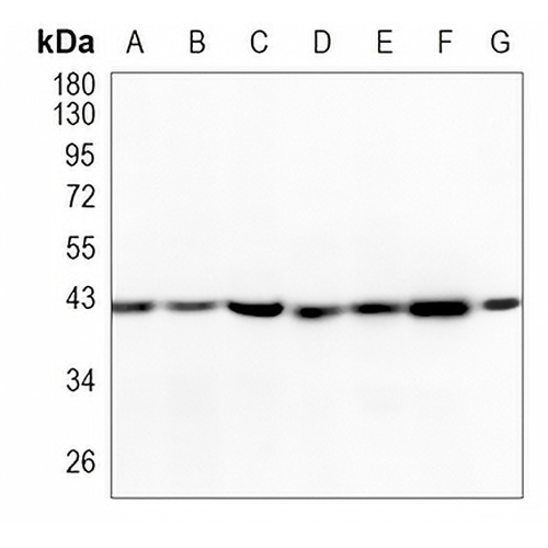 Smooth Muscle Actin Rabbit Monoclonal Antibody(C1015)