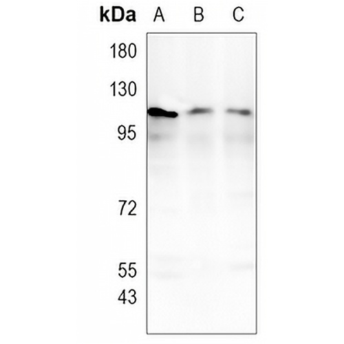 PKN2 Rabbit Monoclonal Antibody(C1016)
