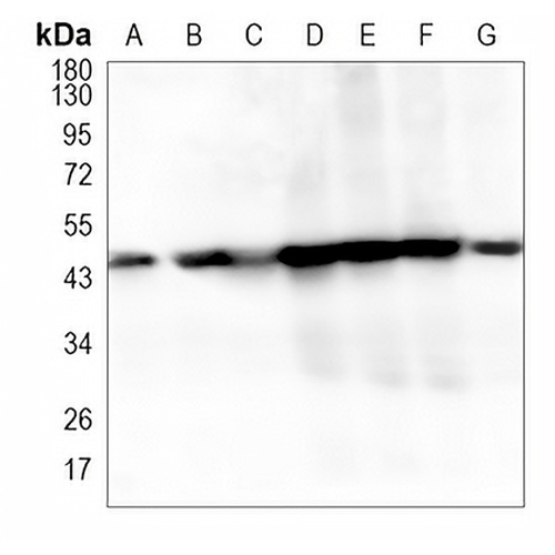 ACAA2 Rabbit Monoclonal Antibody(C1017)