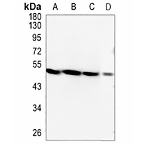 MNX1 Rabbit Monoclonal Antibody(C1019)