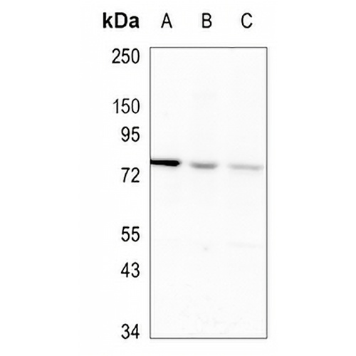RAVER2 Rabbit Monoclonal Antibody(C1020)