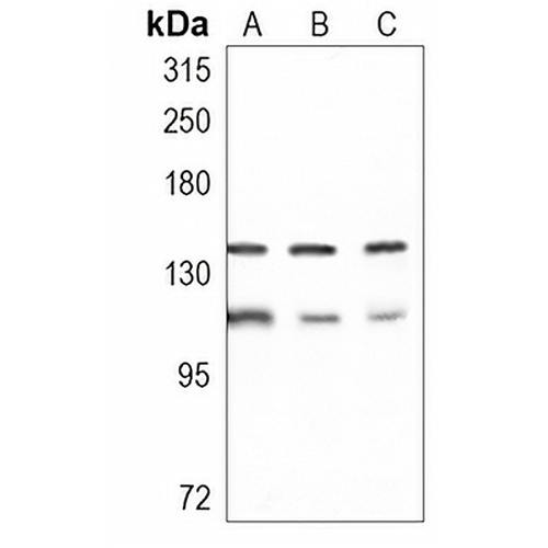 PHF8 Rabbit Monoclonal Antibody(C1021)