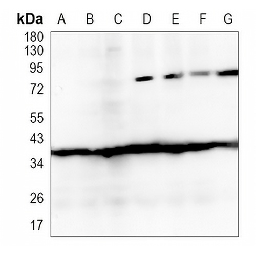 ACAT2 Rabbit Monoclonal Antibody(C1022)