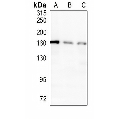 IL-17RA Rabbit Monoclonal Antibody(C1026)