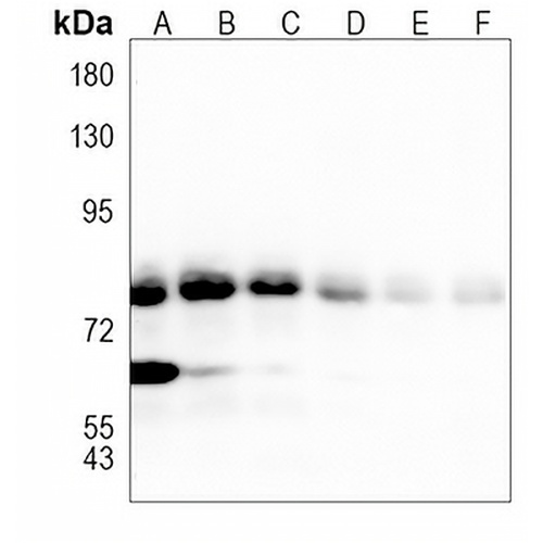 ACSL4 Rabbit Monoclonal Antibody(C1027)