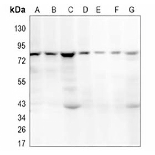 ALDH16A1 Rabbit Monoclonal Antibody(C1028)