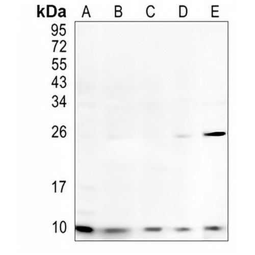NOP10 Rabbit Monoclonal Antibody(C1031)