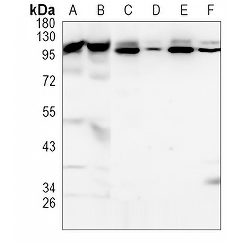 TNPO3 Rabbit Monoclonal Antibody(C1032)