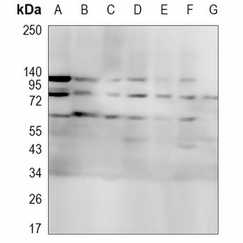KDELR1 Rabbit Monoclonal Antibody(C1033)