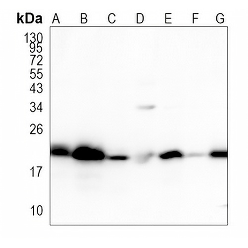 RAP1A/B Rabbit Monoclonal Antibody(C1034)