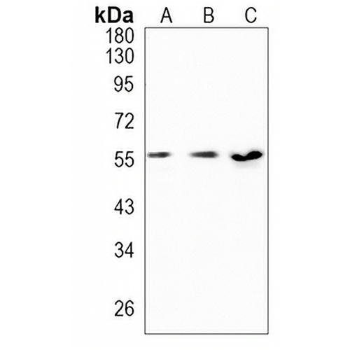 NUP50 Rabbit Monoclonal Antibody(C1035)