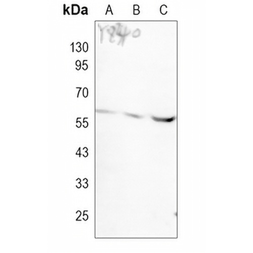 NLK Rabbit Monoclonal Antibody(C1036)