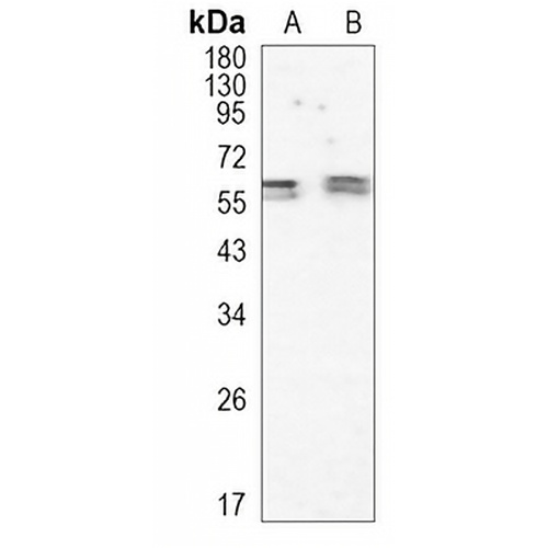 RGS6 Rabbit Monoclonal Antibody(C1037)