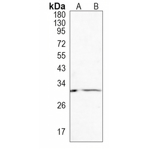 HHEX Rabbit Monoclonal Antibody(C1039)