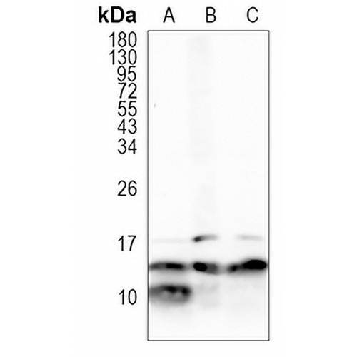 RNF7 Rabbit Monoclonal Antibody(C1041)