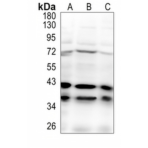 IgG4 Rabbit Monoclonal Antibody(C1043)