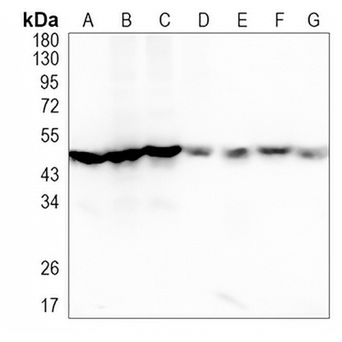 ADSS Rabbit Monoclonal Antibody(C1046)