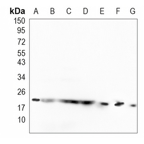 SRP19 Rabbit Monoclonal Antibody(C1052)